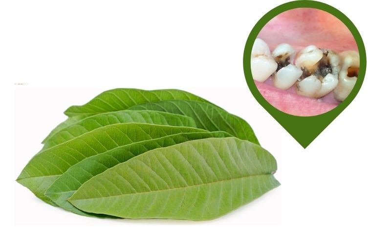 Với khả năng diệt khuẩn của lá ổi giúp cải thiện các tình trạng đau răng do sâu răng