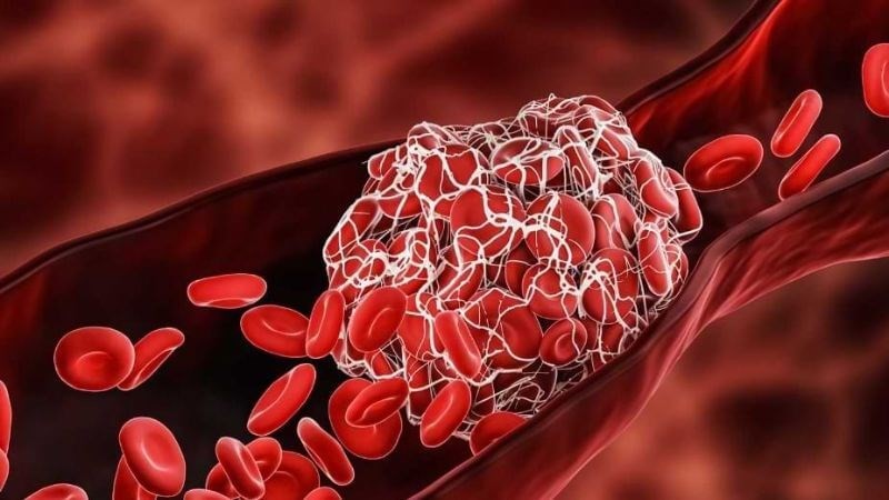 Nên cẩn thận khi dùng nghệ đen trong việc cầm máu, làm lành vết thương